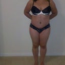12 weeks post op