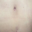 27 days,,,new bb and scar from old one
