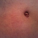 6 Wks PO: close up of belly button. The fold inside are a little more pronounced than before. I wonder if it's swelling or things just settling in.