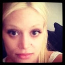 1.5 years after open rhinoplasty - frontal view