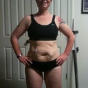 100 Pound Weight Loss Photo
