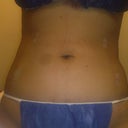 after pic, took on 2/20, front