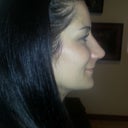 2 weeks post op- right side view. The tip is still very bulbous, but I am definitely much happier.