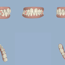 My teeth BEFORE treatment.