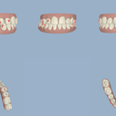 What they should look like after treatment :D So excited at how straight they'll be!