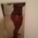 Side, still swollen and hunched over a bit,2 weeks