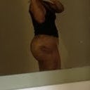 5 Days Post-op