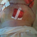 My first view of my stomach!