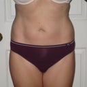 After-6 mos.