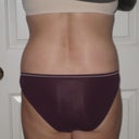 After-6 mos.