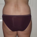 After- 6 mos.