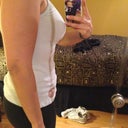 2 weeks 1 day post op no bra