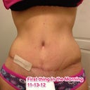 First thing in the morning. I started to put on my strips, then thought I should take a quick pic.