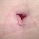 POD 22: WTF is up with my BB??? At least it's not horribly deformed, but I am worried about the bottom of it.