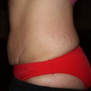 Before side view