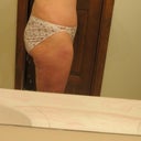 18 days after additional lipo