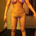 5 days post op