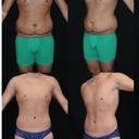Before and 6 months after