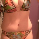 10.5 weeks post op (late afternoon, slightly swollen)