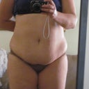 front pre-op
