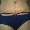 3 week scar