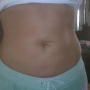 new stomach!!  :-)  3/08