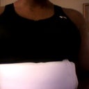 after.. 3 days post op
