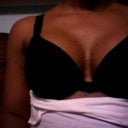 2 months post op