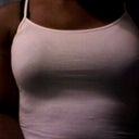two months post op