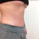 Side view 12 weeks.