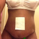 Super swollen pod 6