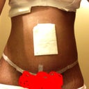 pod 5, A lot of swelling before shower