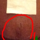 See my vertical scar