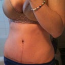 8 weeks..still looks the same! Still waiting for it to sloooowly fade