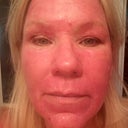 6 days after