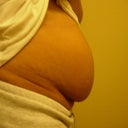 b4 lipo