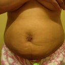 4 weeks after lipo