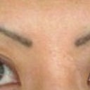 After brows