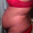 6days pre op side