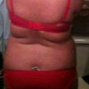6days pre op back