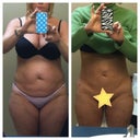 before and 3 weeks after
