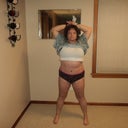 7 weeks post op photo