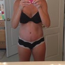Front side at 12 weeks PO