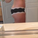 Side view 12 weeks PO