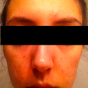 Month 2