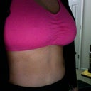 post op day 10