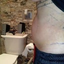 was scared cause of the hot skin and swelling.. 
Day 6-7