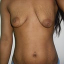 very very bad asymmetry!! >>sighs<<