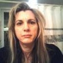 Two Days After Juvaderm and Botox