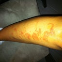 2 days after lower leg hair removal